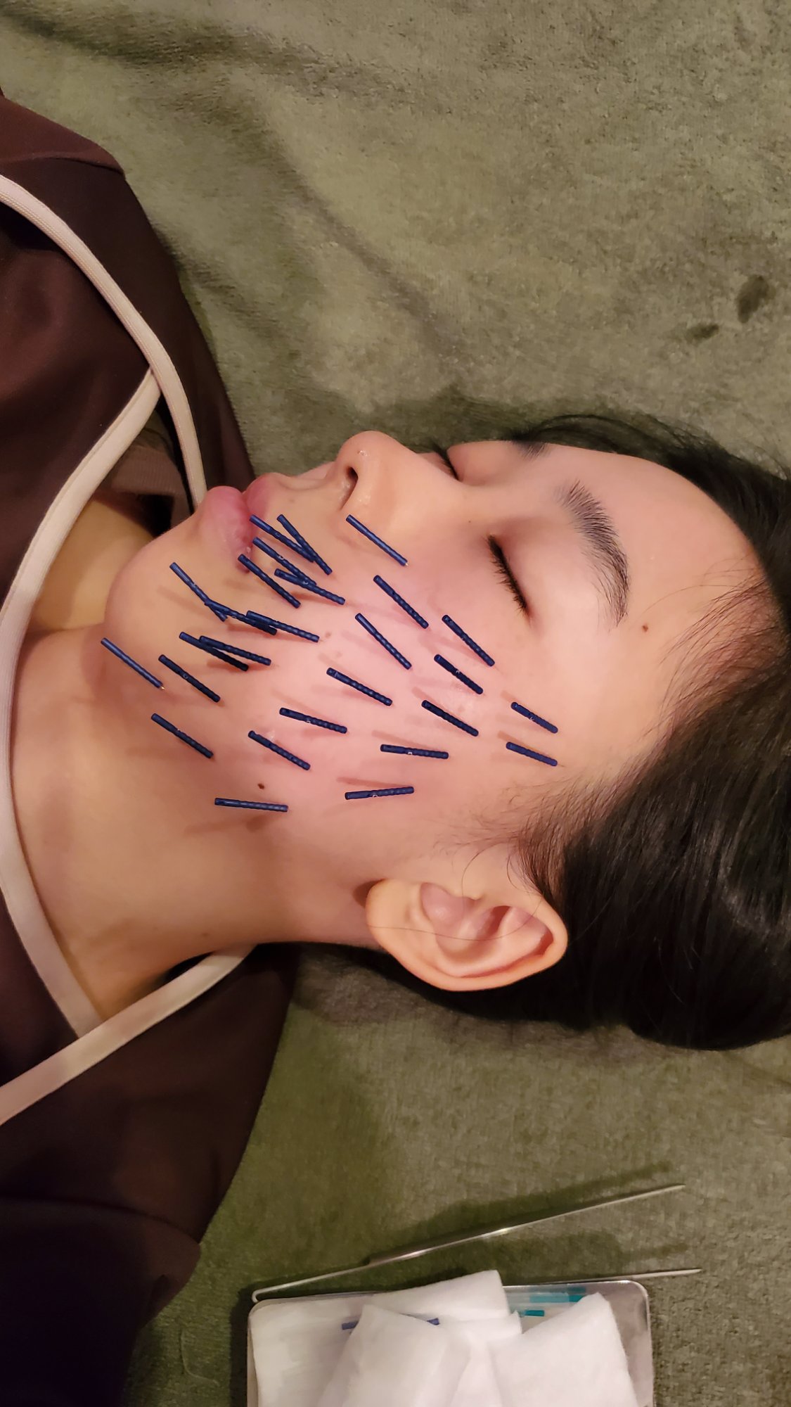 長期アプローチ